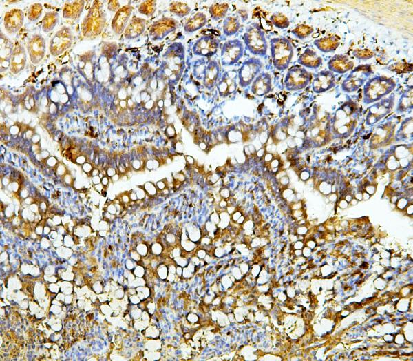2 - Anti-Galectin 3/LGALS3 Antibody Picoband™ (monoclonal, 12B12) ABO14834