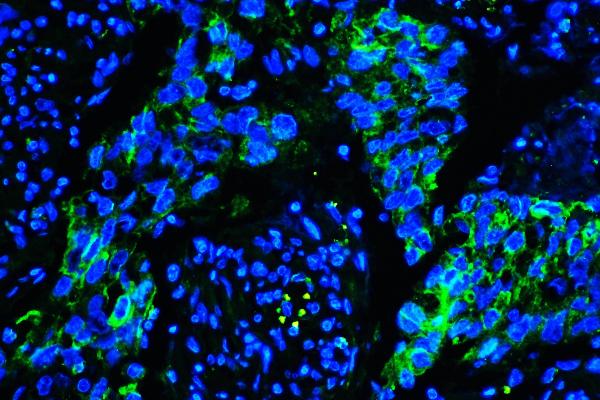 3 - Anti-Caveolin-1/CAV1 Antibody Picoband™ (monoclonal, 12C7) ABO14835