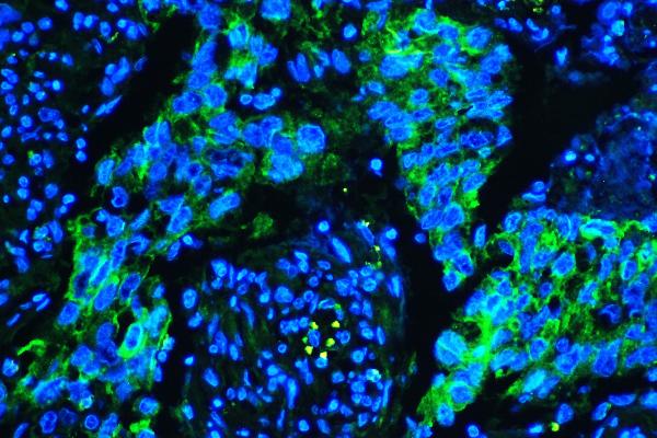 3 - Anti-Caveolin-1/CAV1 Antibody Picoband™ (monoclonal, 12C7) ABO14835