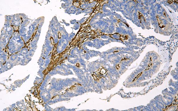 2 - Anti-Caveolin-1/CAV1 Antibody Picoband™ (monoclonal, 12C7) ABO14835