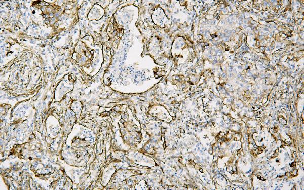 2 - Anti-Caveolin-1/CAV1 Antibody Picoband™ (monoclonal, 12C7) ABO14835