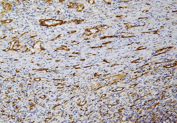 2 - Anti-Caveolin-1/CAV1 Antibody Picoband™ (monoclonal, 12C7) ABO14835
