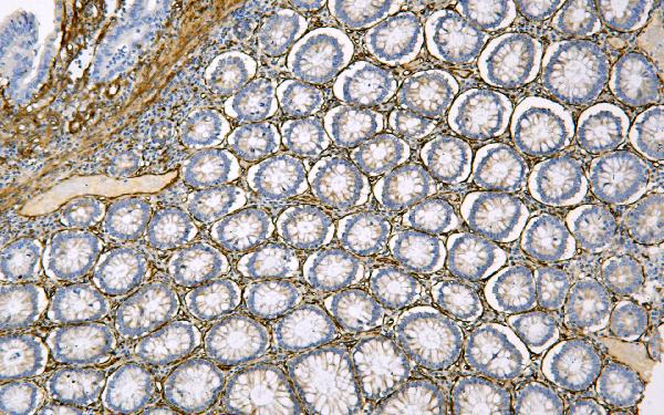 2 - Anti-Caveolin-1/CAV1 Antibody Picoband™ (monoclonal, 12C7) ABO14835