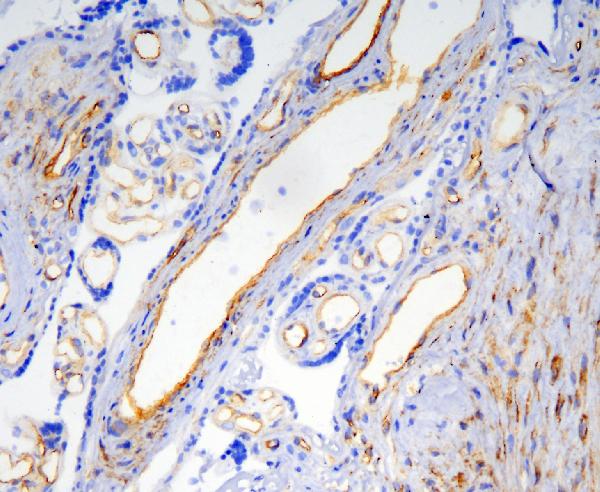 2 - Anti-Caveolin-1/CAV1 Antibody Picoband™ (monoclonal, 12C7) ABO14835
