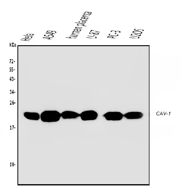 1 - Anti-Caveolin-1/CAV1 Antibody Picoband™ (monoclonal, 12C7) ABO14835