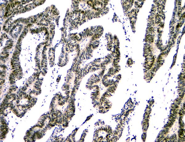 2 - Anti-NFIA Antibody Picoband™ (monoclonal, 16H11) ABO14836