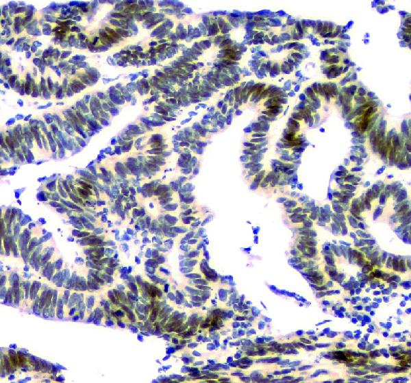 2 - Anti-NFIA Antibody Picoband™ (monoclonal, 16H11) ABO14836