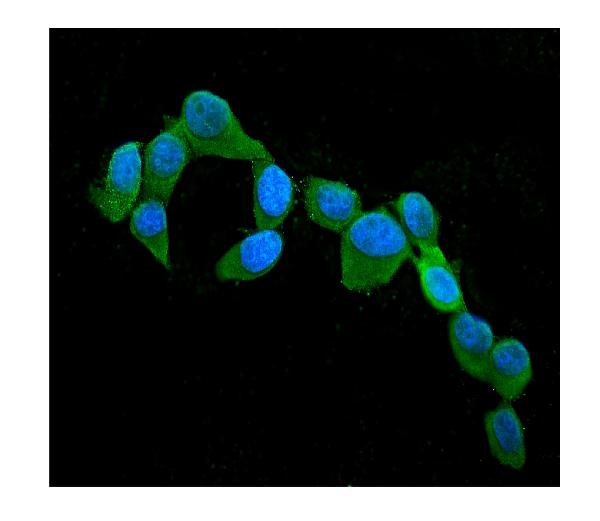3 - Anti-Cystatin C/CST3 Antibody Picoband™ (monoclonal, 4H8) ABO14837