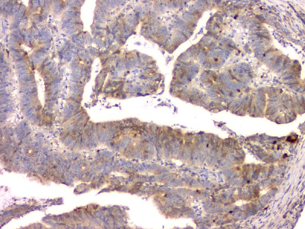 2 - Anti-Cystatin C/CST3 Antibody Picoband™ (monoclonal, 4H8) ABO14837