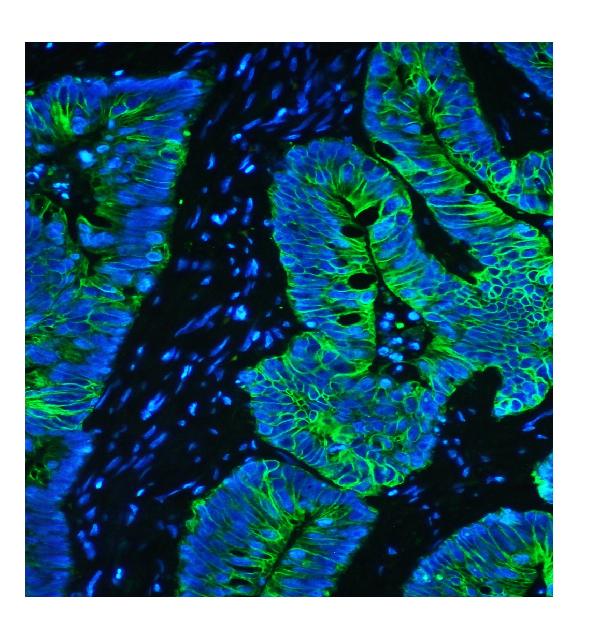 3 - Anti-Cytokeratin 8 KRT8 Antibody Picoband™ (monoclonal, 3G9) ABO14840