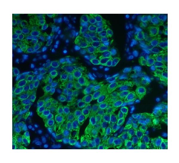 3 - Anti-Cytokeratin 8 KRT8 Antibody Picoband™ (monoclonal, 3G9) ABO14840