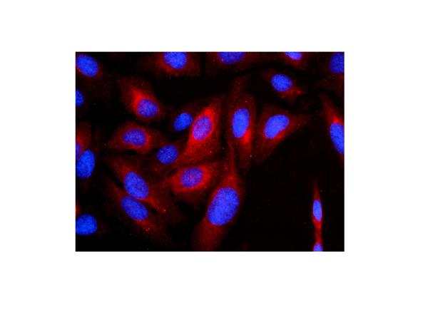 3 - Anti-Cytokeratin 8 KRT8 Antibody Picoband™ (monoclonal, 3G9) ABO14840