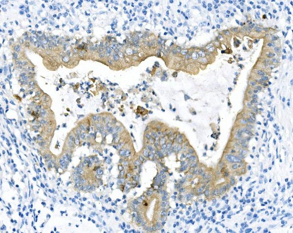 2 - Anti-Cytokeratin 8 KRT8 Antibody Picoband™ (monoclonal, 3G9) ABO14840
