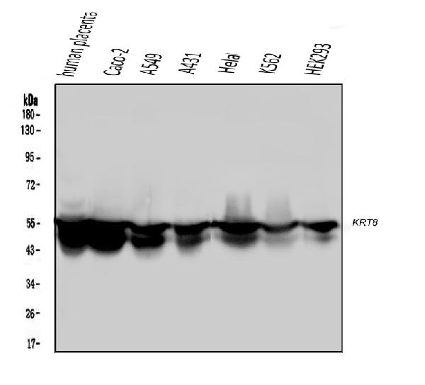 1 - Anti-Cytokeratin 8 KRT8 Antibody Picoband™ (monoclonal, 3G9) ABO14840