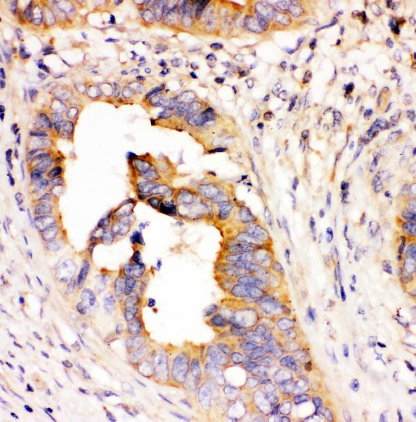 2 - Anti-DHFR Antibody Picoband™ (monoclonal, 3C8) ABO14841