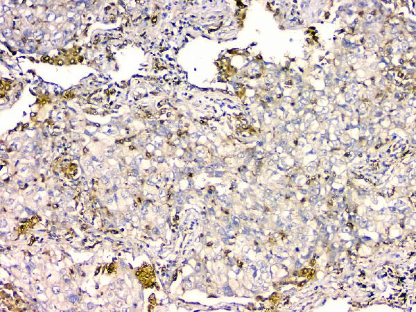 2 - Anti-GPX1 Antibody Picoband™ (monoclonal, 8B10) ABO14842