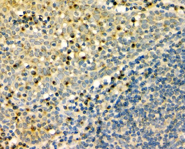 2 - Anti-GM130 GOLGA2 Antibody Picoband™ (monoclonal, 4G3) ABO14843