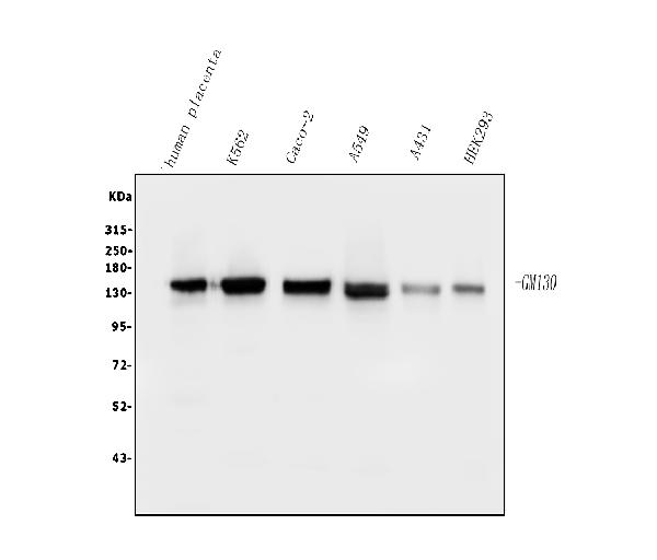 1 - Anti-GM130 GOLGA2 Antibody Picoband™ (monoclonal, 4G3) ABO14843