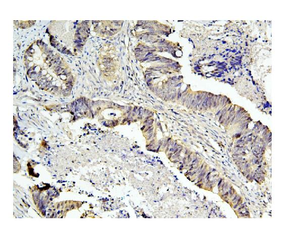 2 - Anti-Caspase-3 Antibody Picoband™ (monoclonal, 8B6) ABO14844