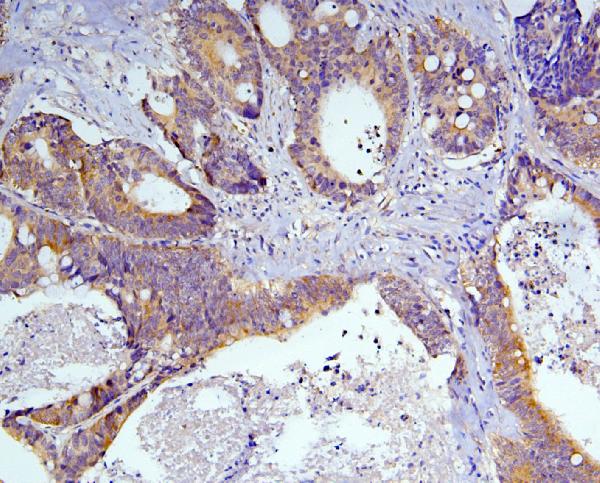 2 - Anti-Caspase-3 Antibody Picoband™ (monoclonal, 15G8) ABO14845