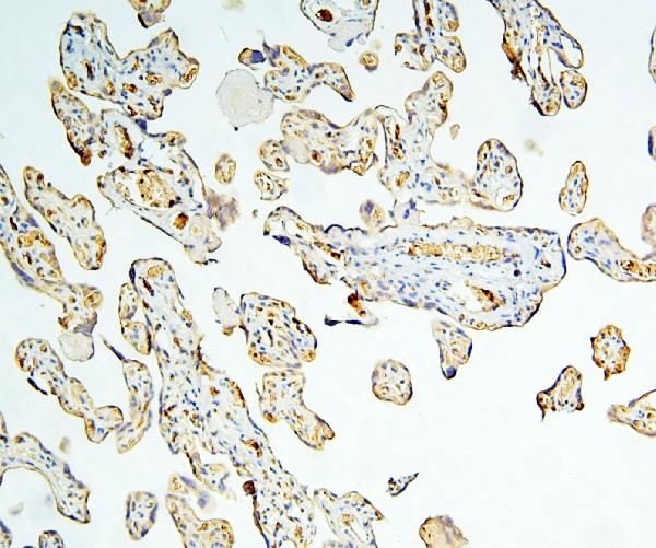 2 - Anti-Caspase-3 Antibody Picoband™ (monoclonal, 15G8) ABO14845