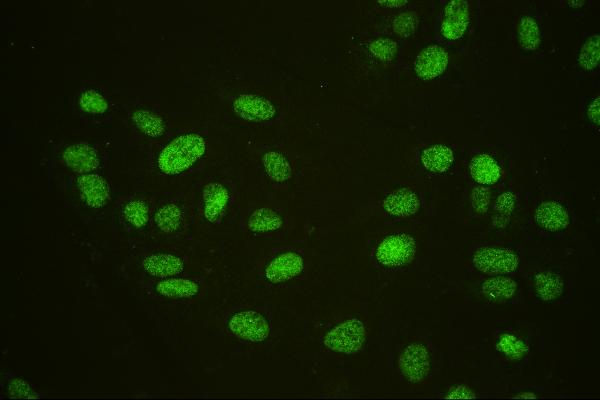 3 - Anti-HAUSP/USP7 Antibody Picoband™ (monoclonal, 5E2) ABO14847