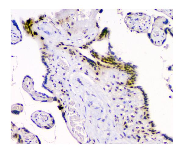2 - Anti-HAUSP/USP7 Antibody Picoband™ (monoclonal, 5E2) ABO14847