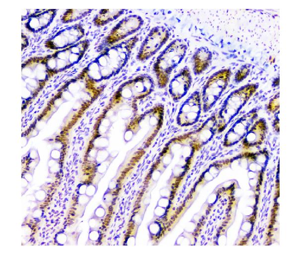 2 - Anti-HAUSP/USP7 Antibody Picoband™ (monoclonal, 5E2) ABO14847