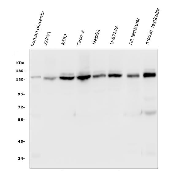 1 - Anti-HAUSP/USP7 Antibody Picoband™ (monoclonal, 5E2) ABO14847