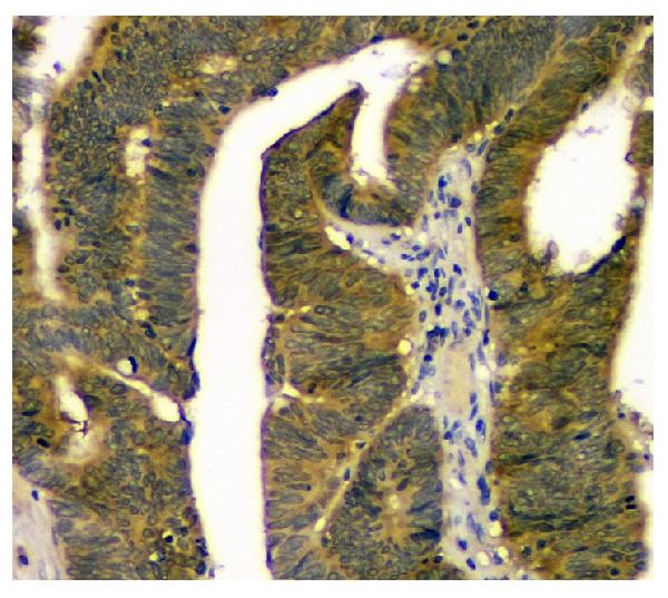 2 - Anti-STUB1 Antibody Picoband™ (monoclonal, 13I8) ABO14848