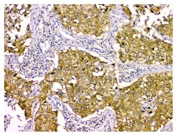 2 - Anti-STUB1 Antibody Picoband™ (monoclonal, 13I8) ABO14848