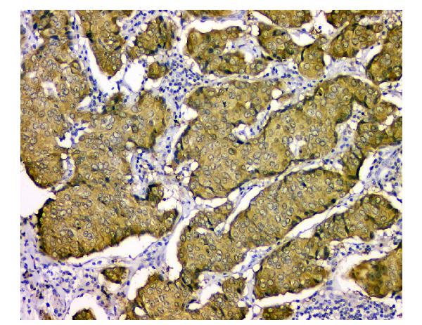 2 - Anti-STUB1 Antibody Picoband™ (monoclonal, 13I8) ABO14848