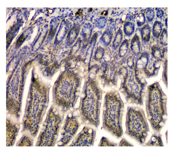 2 - Anti-STUB1 Antibody Picoband™ (monoclonal, 13I8) ABO14848