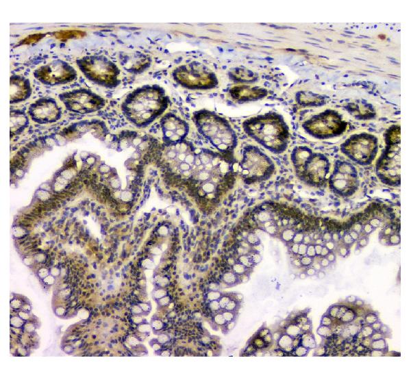 2 - Anti-STUB1 Antibody Picoband™ (monoclonal, 13I8) ABO14848