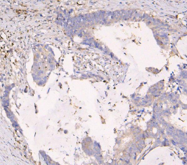 2 - Anti-APOBEC3G Antibody Picoband™ (monoclonal, 6C2) ABO14849