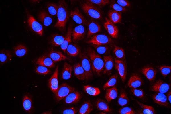 3 - Anti-Cyclophilin B PPIB Antibody Picoband™ (monoclonal, 11C11) ABO14850