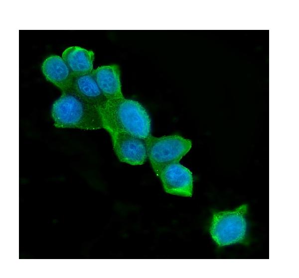 3 - Anti-ATP citrate lyase ACLY Antibody Picoband™ (monoclonal, 5I2) ABO14851