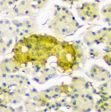 2 - Anti-ATP citrate lyase ACLY Antibody Picoband™ (monoclonal, 5I2) ABO14851