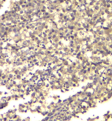 2 - Anti-ATP citrate lyase ACLY Antibody Picoband™ (monoclonal, 5I2) ABO14851