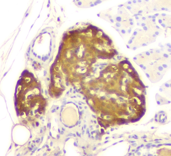 2 - Anti-ATP citrate lyase ACLY Antibody Picoband™ (monoclonal, 5I2) ABO14851