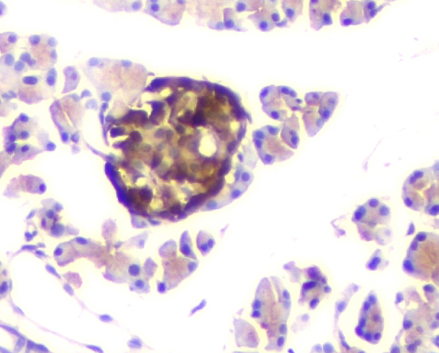 2 - Anti-ATP citrate lyase ACLY Antibody Picoband™ (monoclonal, 5I2) ABO14851