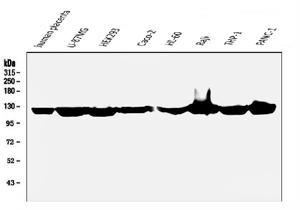 1 - Anti-ATP citrate lyase ACLY Antibody Picoband™ (monoclonal, 5I2) ABO14851