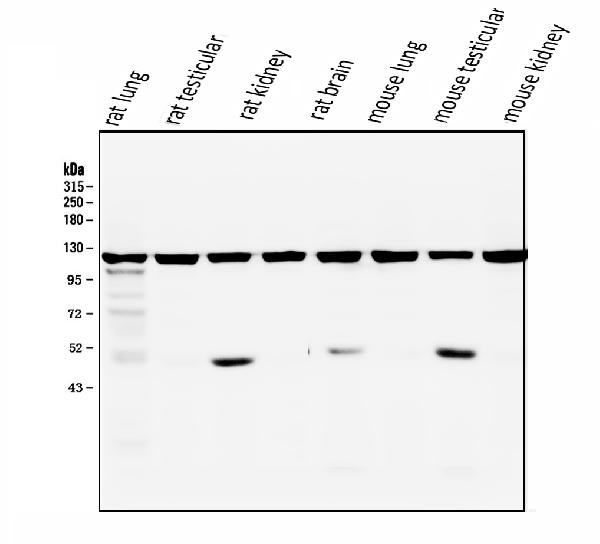 1 - Anti-ATP citrate lyase ACLY Antibody Picoband™ (monoclonal, 5I2) ABO14851