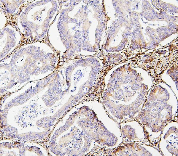 2 - Anti-Collagen III/COL3A1 Antibody Picoband™ (monoclonal, 9H9) ABO14852