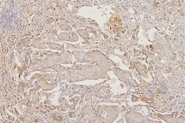 2 - Anti-Collagen III/COL3A1 Antibody Picoband™ (monoclonal, 9H9) ABO14852