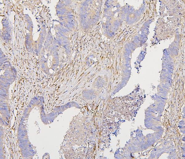 2 - Anti-Collagen III/COL3A1 Antibody Picoband™ (monoclonal, 9H9) ABO14852
