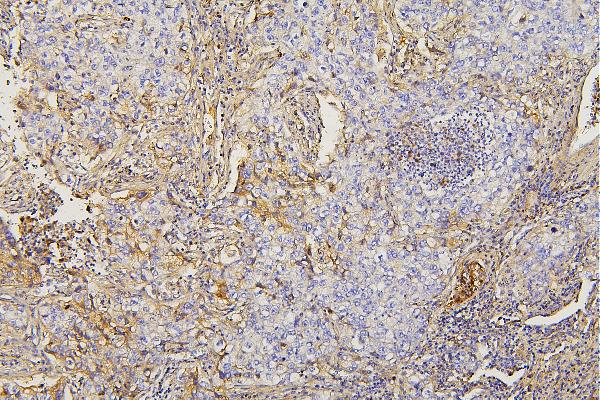 2 - Anti-Collagen III/COL3A1 Antibody Picoband™ (monoclonal, 9H9) ABO14852