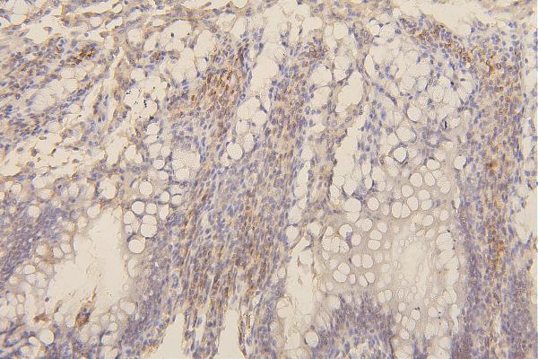 2 - Anti-Collagen III/COL3A1 Antibody Picoband™ (monoclonal, 9H9) ABO14852