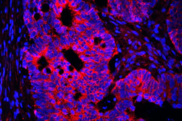 3 - Anti-AIF/AIFM1 Antibody Picoband™ (monoclonal, 2I5) ABO14853