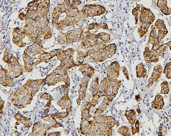 2 - Anti-AIF/AIFM1 Antibody Picoband™ (monoclonal, 2I5) ABO14853